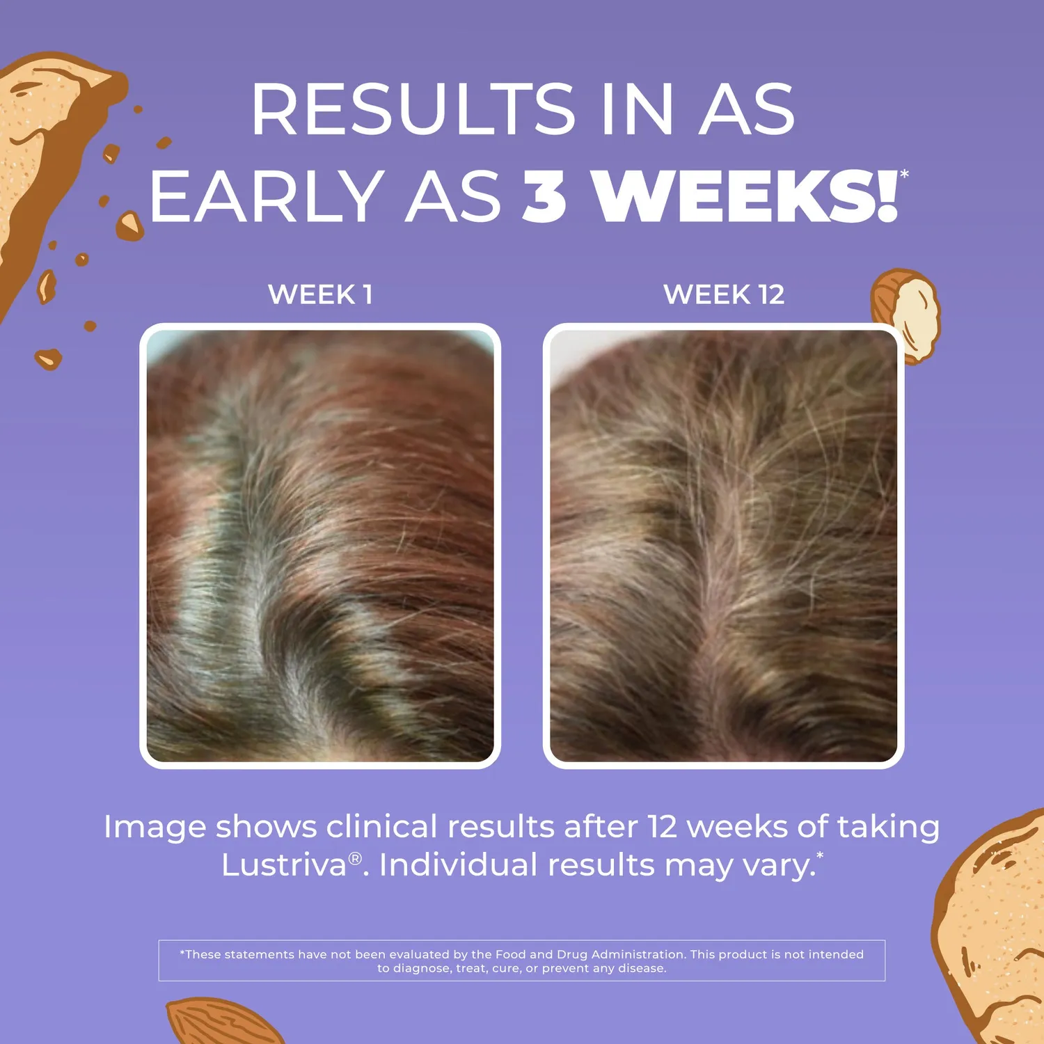 MaryRuth's Hair Growth Max hårtilskudd mandel 30 doser fyldig